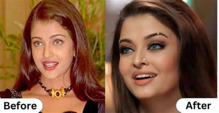Aishwarya Rai Face Surgery: Truth Behind the Transformation