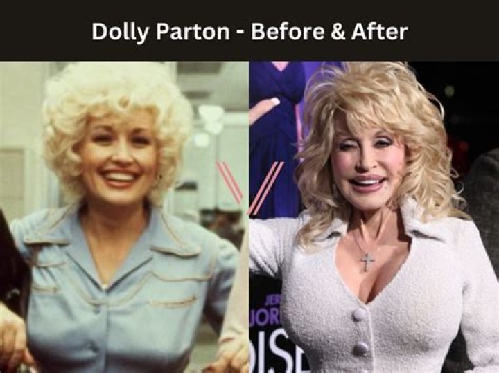 Dolly Parton Cup Size: Unveiling the Icon's Figure