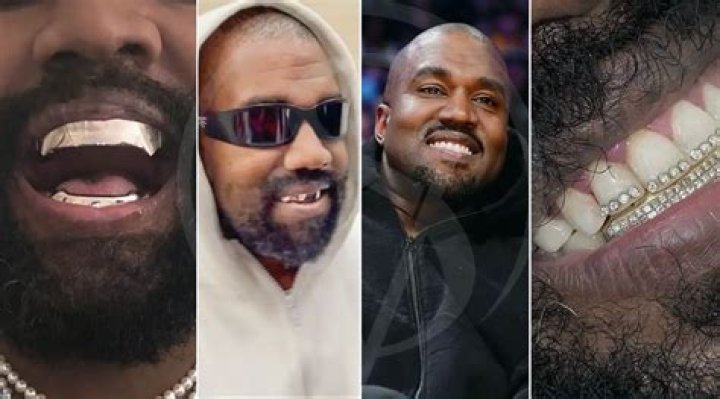Kanye West Teeth: A Journey Through His Iconic Smile and Dental Transformation