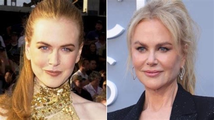 Nicole Kidman Face: The Timeless Beauty Behind the Iconic Actress