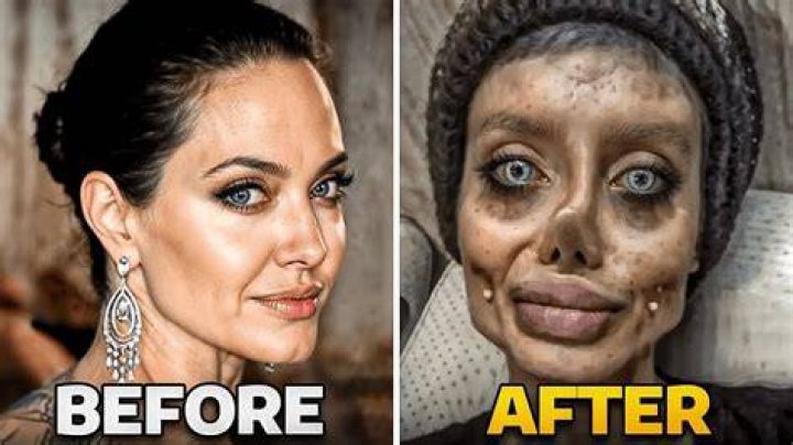 Skyelar Chase and Her Journey Through Plastic Surgery: A Comprehensive Analysis