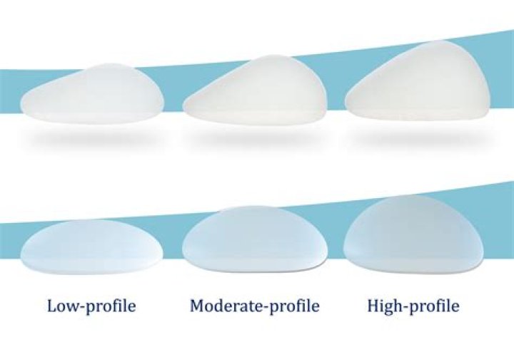 Understanding Fake Tits: The Comprehensive Guide to Breast Augmentation