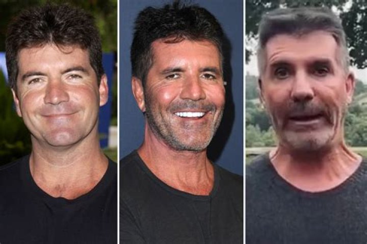 What is Simon Cowell's Illness? Understanding His Health Journey